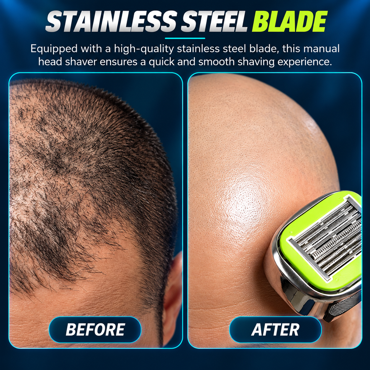 ZORVA Bald Shaver