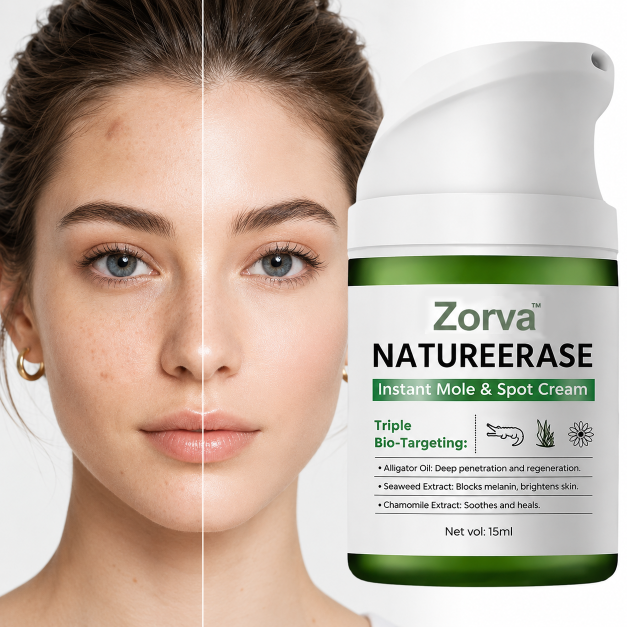 Zorva NatureErase Instant Mole & Spot Cream