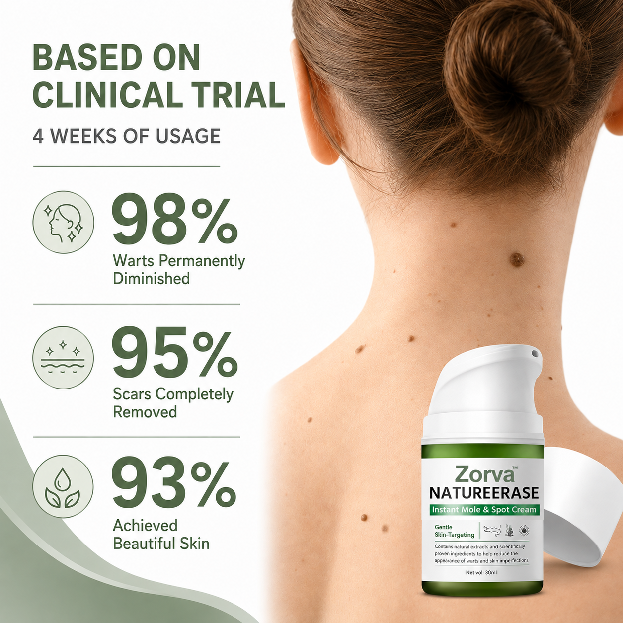 Zorva NatureErase Instant Mole & Spot Cream